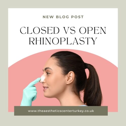 Closed vs Open Rhinoplasty