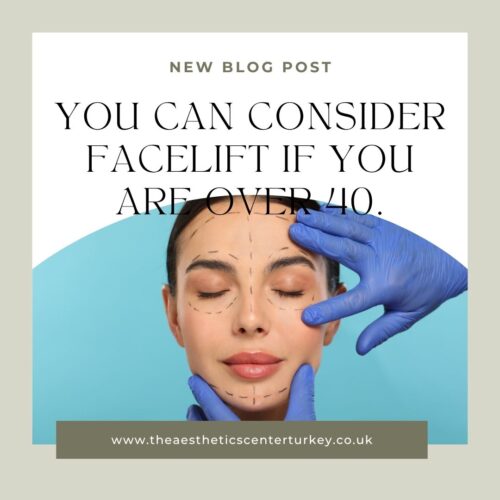 Facelift for Age 40+