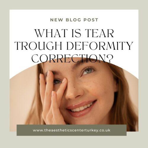 Tear Trough Deformity Correction
