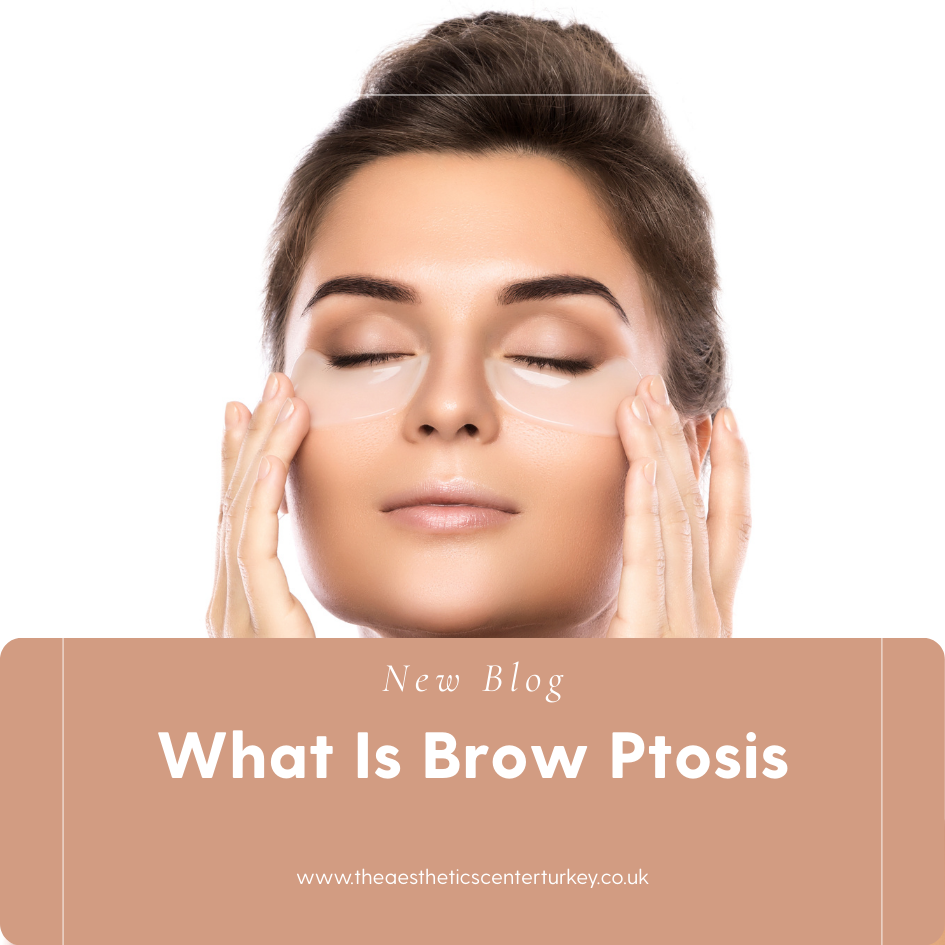 What Is Brow Ptosis