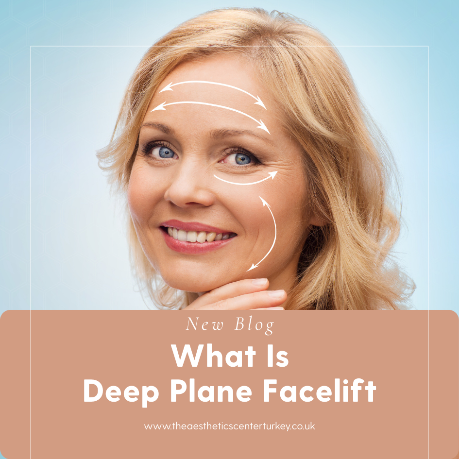 What Is Deep Plane Facelift