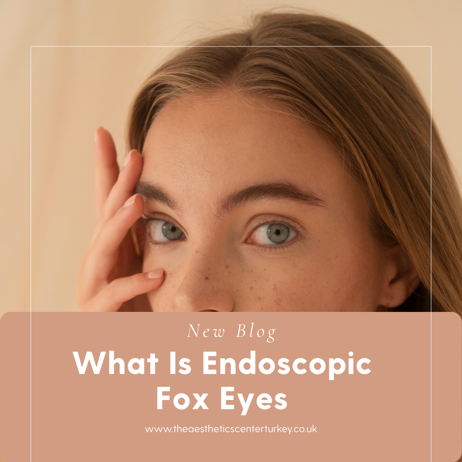 What Is Endoscopic Fox Eyes?