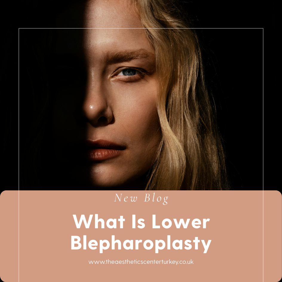 What Is Lower Blepharoplasty?